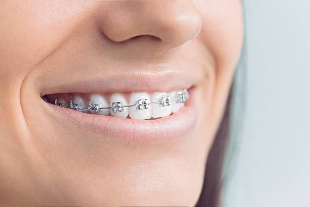 Best Dental Fillings (Composite and Amalgam)  in Redwood Falls, MN